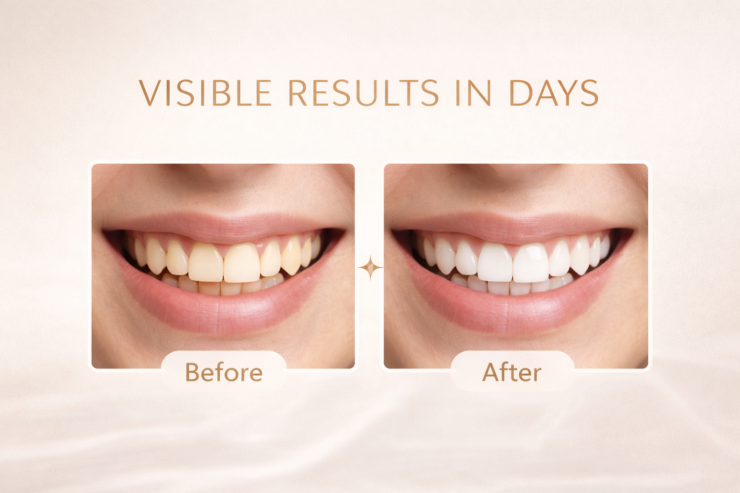 Professional PAP+ Teeth Whitening Strips